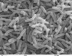 Koleranın etkeni olan Vibrio cholerae bakterilerinin taramalı elektron mikroskopisi ile elde edilmiş bir görüntüsü.